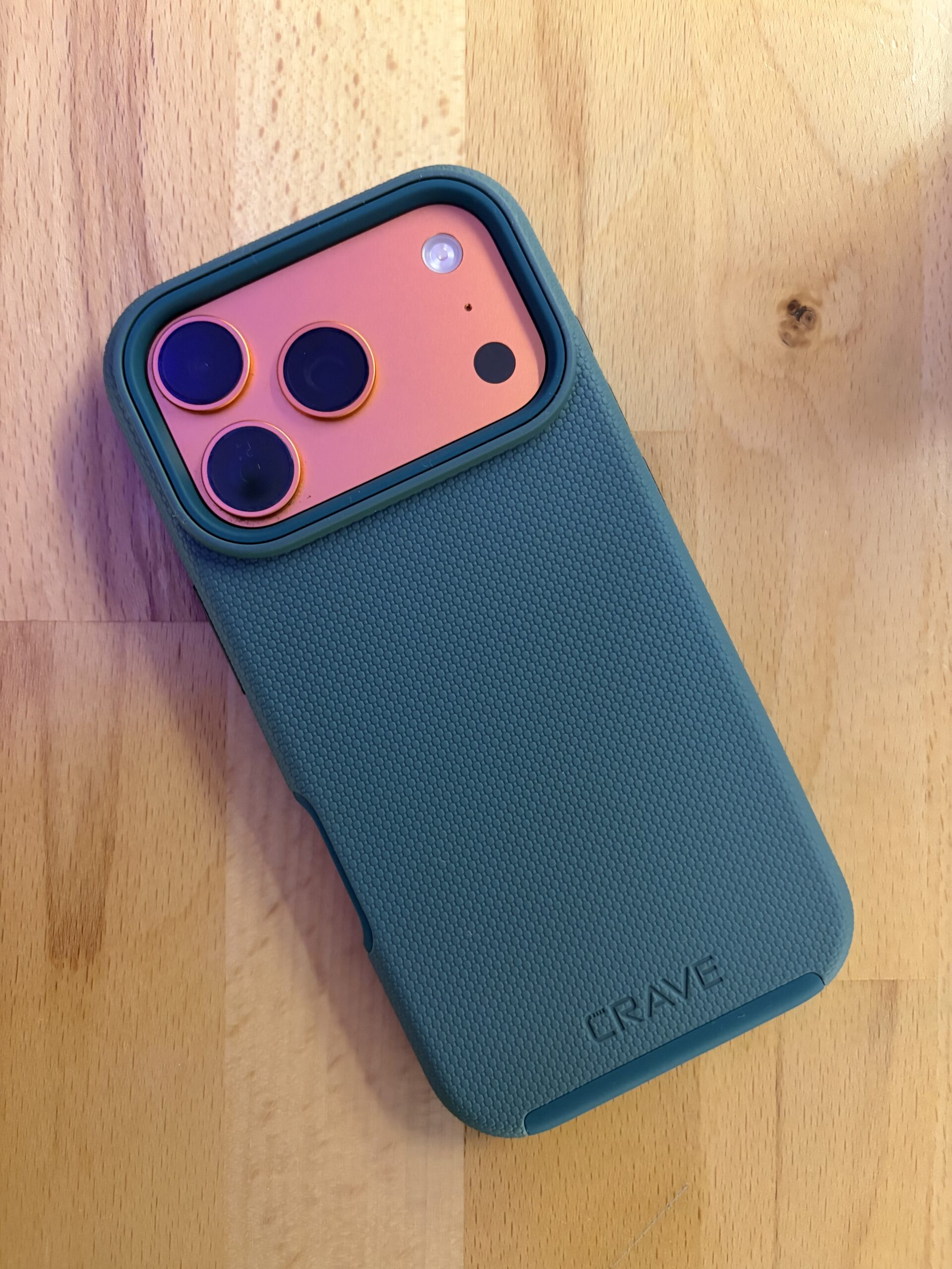 dua lipa phone case Dua Lipa